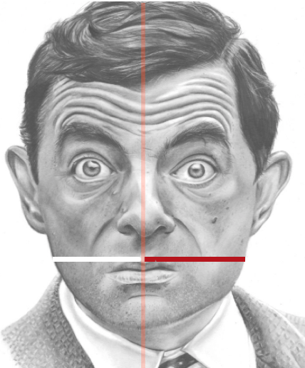 Facial Aesthetics - The Myth of Symmetry - Visage MedArt